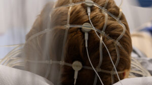 BADANIA EEG KRAKÓW, EEG GRAF